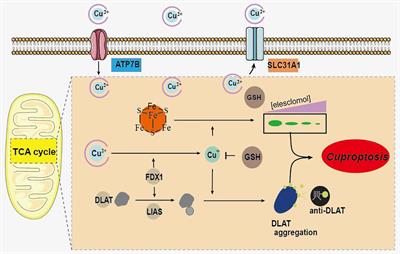 Comprehensive analysis of cuproptosis-related genes in immune infiltration and diagnosis in ulcerative colitis